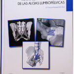 Tratamiento Osteopático de Las Algias Lumbopélvicas