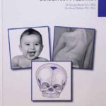 Osteopatía e Pediatria